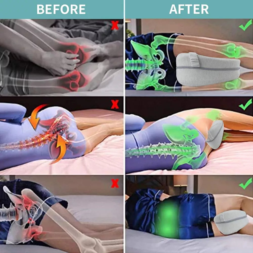 Orthopedic Knee Pillow – Comfort & Support for Side Sleepers