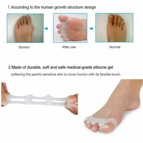 Hammer Toe Splint – Orthopedic Toe Corrector for Foot Pain Relief