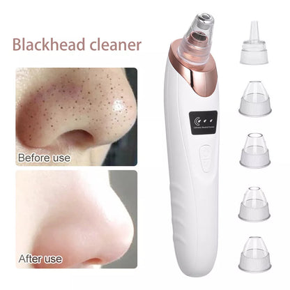 5-in-1 Portable Electric Blackhead Suction Device with 5 T9O8