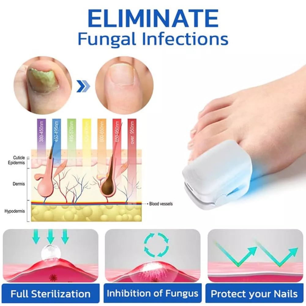 Nail Fungus Cleaning Laser Device