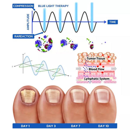 Nail Fungus Cleaning Laser Device