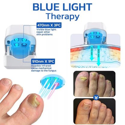 Nail Fungus Cleaning Laser Device