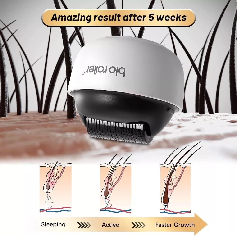 Hair Renewal Roller – 1200 Microneedles for Scalp & Beard Growth
