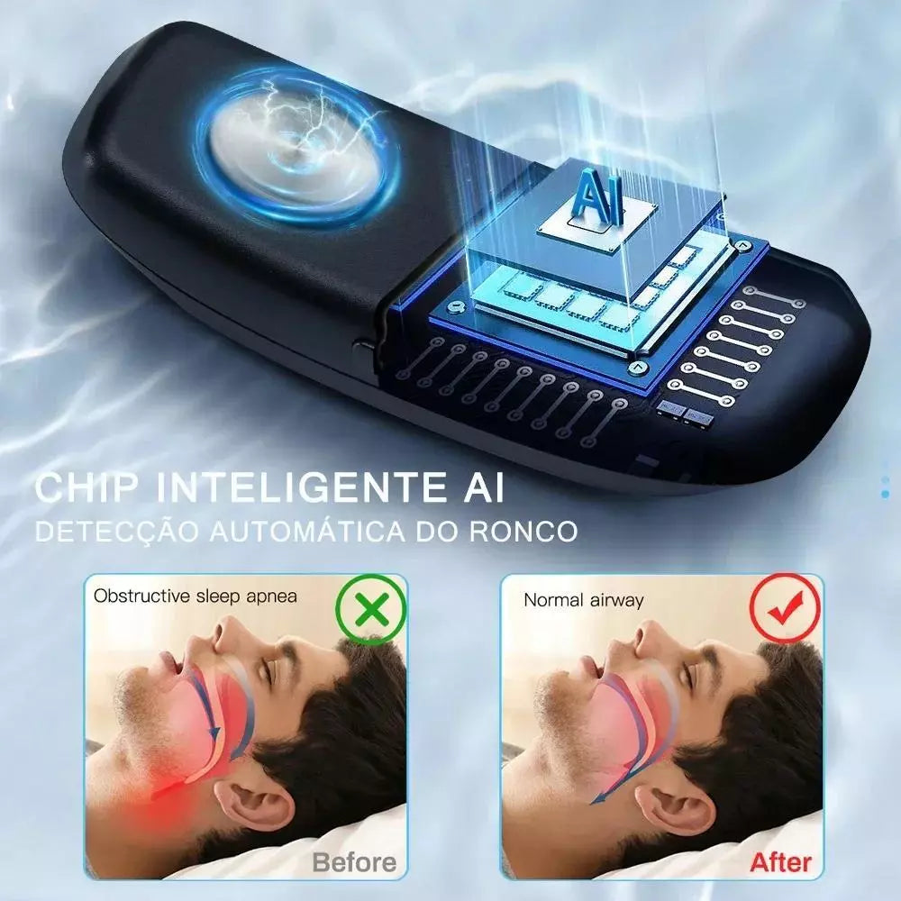Smart Anti Snoring Device EMS Pulse Stop Snore Portable Comfortable Sleep Well Stop Snore Health Care Sleep Apnea Aid USB